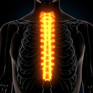 Florida spinal cord injuries lawyer
